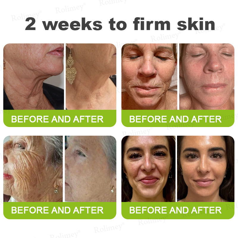 💟Made and shipped from the USA 💫Rolimey® Botox & Vita-A Retinol Shot Wrinkle-Lift Tightening cream - Last Day Promotion 70% OFF