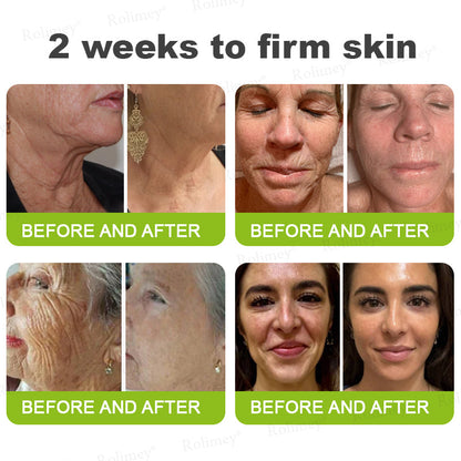 💟Made and shipped from the USA 💫Rolimey® Botox & Vita-A Retinol Shot Wrinkle-Lift Tightening cream - Last Day Promotion 70% OFF