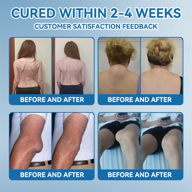 👩‍⚕️🦴FDA Approved|𝒁𝐯𝐨𝐞𝐯𝐨® BPC-157 Joint Healing Cream 🦴 Treats Arthritis, Neuropathy, Rheumatism, Sports Injuries & More