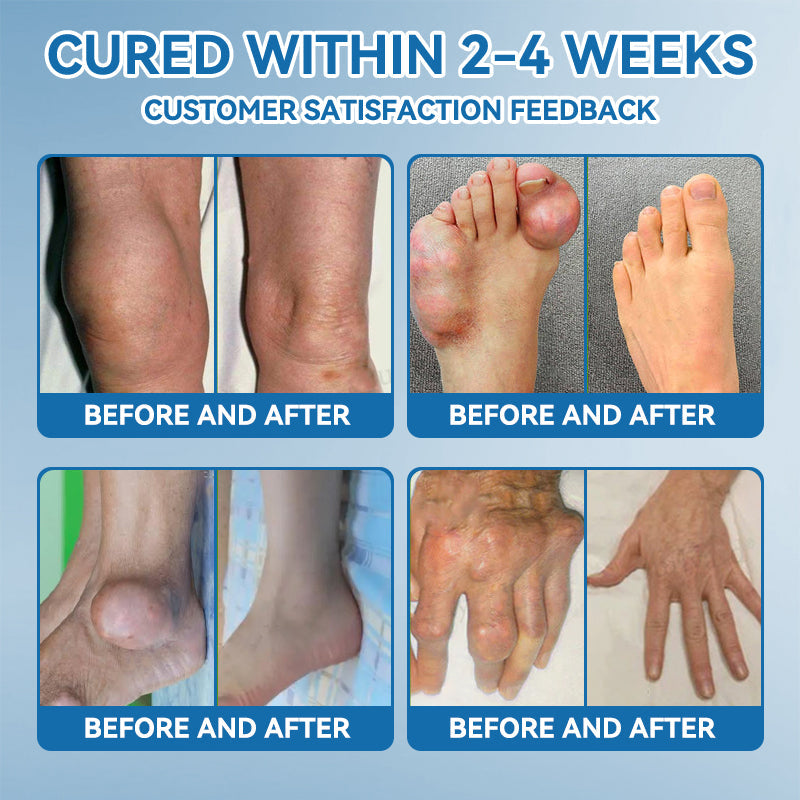 👩‍⚕️🦴FDA Approved|𝒁𝐯𝐨𝐞𝐯𝐨® BPC-157 Joint Healing Cream 🦴 Treats Arthritis, Neuropathy, Rheumatism, Sports Injuries & More