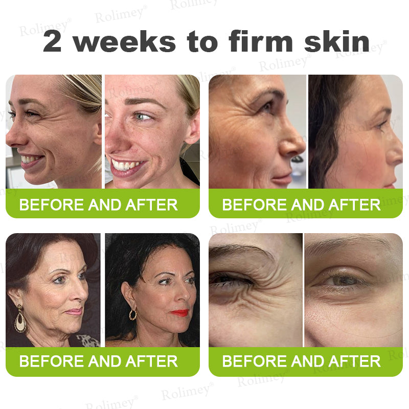 💟Made and shipped from the USA 💫Rolimey® Botox & Vita-A Retinol Shot Wrinkle-Lift Tightening cream - Last Day Promotion 70% OFF