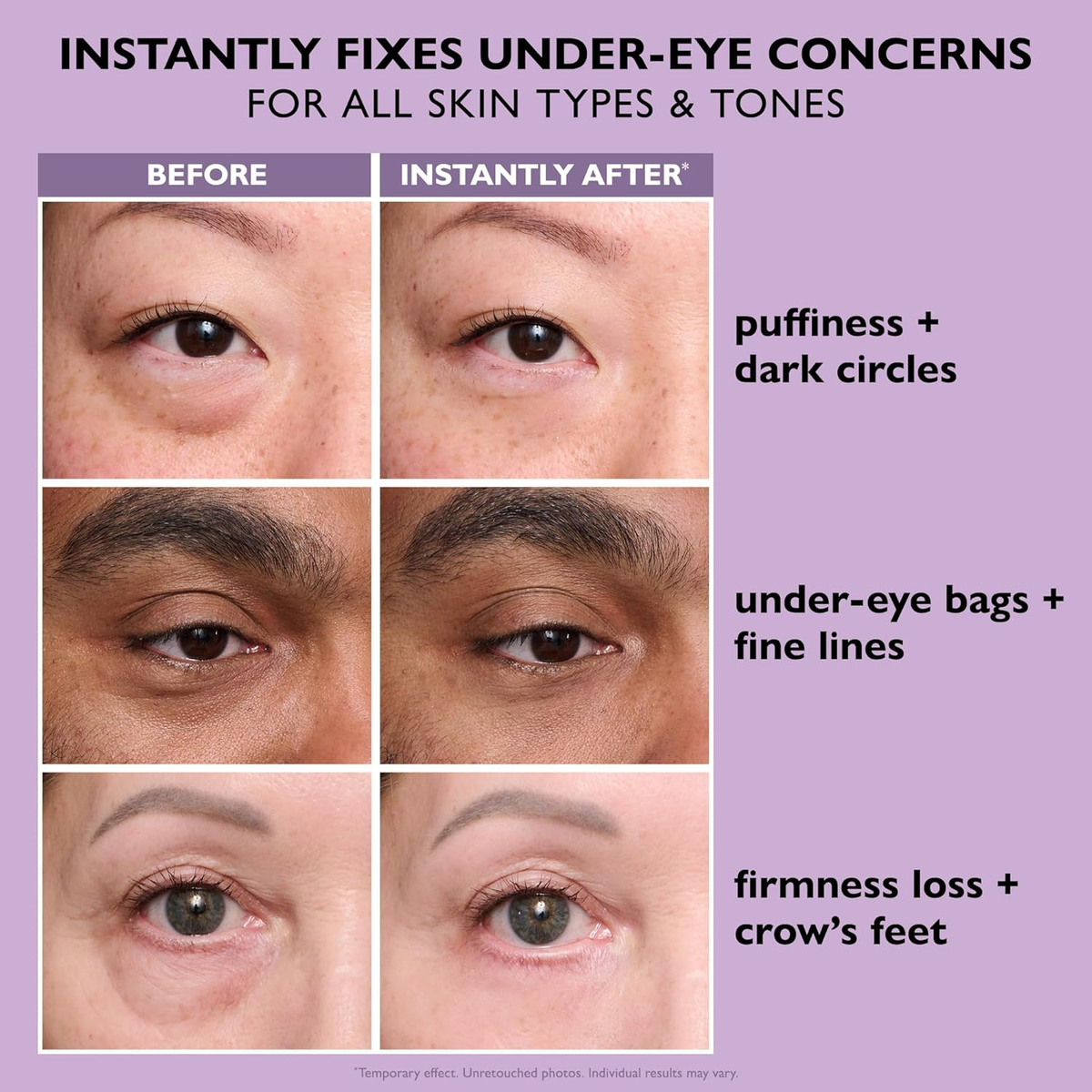 🔥  Last 3 Hours 50% OFF  ✨ BUY 1 GET 1 FREE🔥Eye Bag Eraser — Instantly Refreshes, Firms & Smooths for a Youthful Look That Lasts 8 Hours