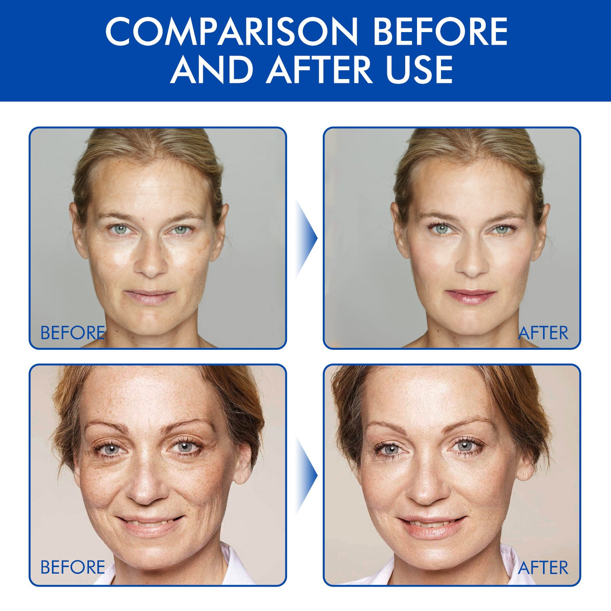 🔥🔥🔥 Last Day 79% OFF Firming Anti-Aging Facial Serum
