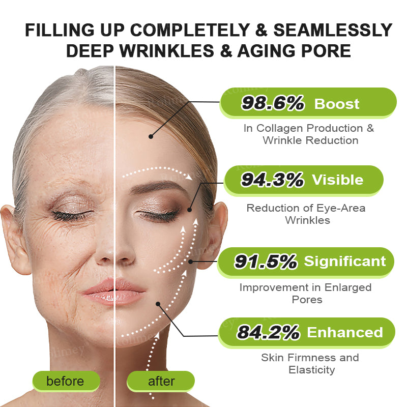 💟Made and shipped from the USA 💫Rolimey® Botox & Vita-A Retinol Shot Wrinkle-Lift Tightening cream - Last Day Promotion 70% OFF