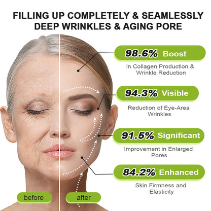 💟Made and shipped from the USA 💫Rolimey® Botox & Vita-A Retinol Shot Wrinkle-Lift Tightening cream - Last Day Promotion 70% OFF
