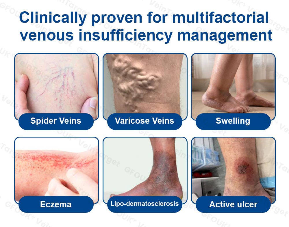 💟💟GFOUK® VeinPulse Advanced Transdermal Microneedle System⚡Instant Relief, Long-Term Results