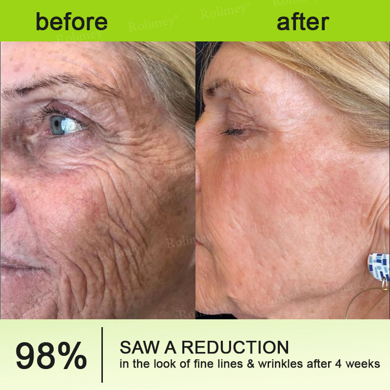 💟Made and shipped from the USA 💫Rolimey® Botox & Vita-A Retinol Shot Wrinkle-Lift Tightening cream - Last Day Promotion 70% OFF