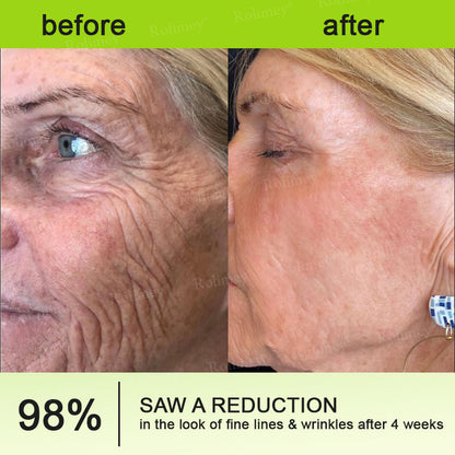 💟Made and shipped from the USA 💫Rolimey® Botox & Vita-A Retinol Shot Wrinkle-Lift Tightening cream - Last Day Promotion 70% OFF