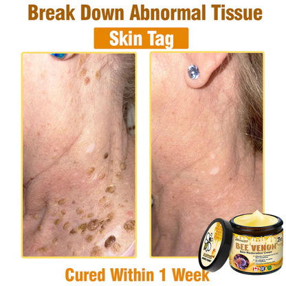 🍁Ourlyard® Bee venom Pro Comprehensive Cream — 🔥Limited Time 80% OFF🔥