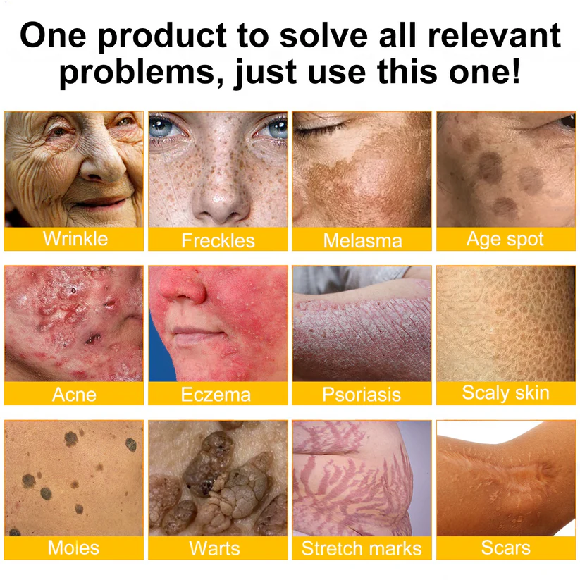 🌤️FDA Approved: Ourlyard® Bee Venom Skin Restoration Cream — 🥇Limited Time 80% OFF🔥