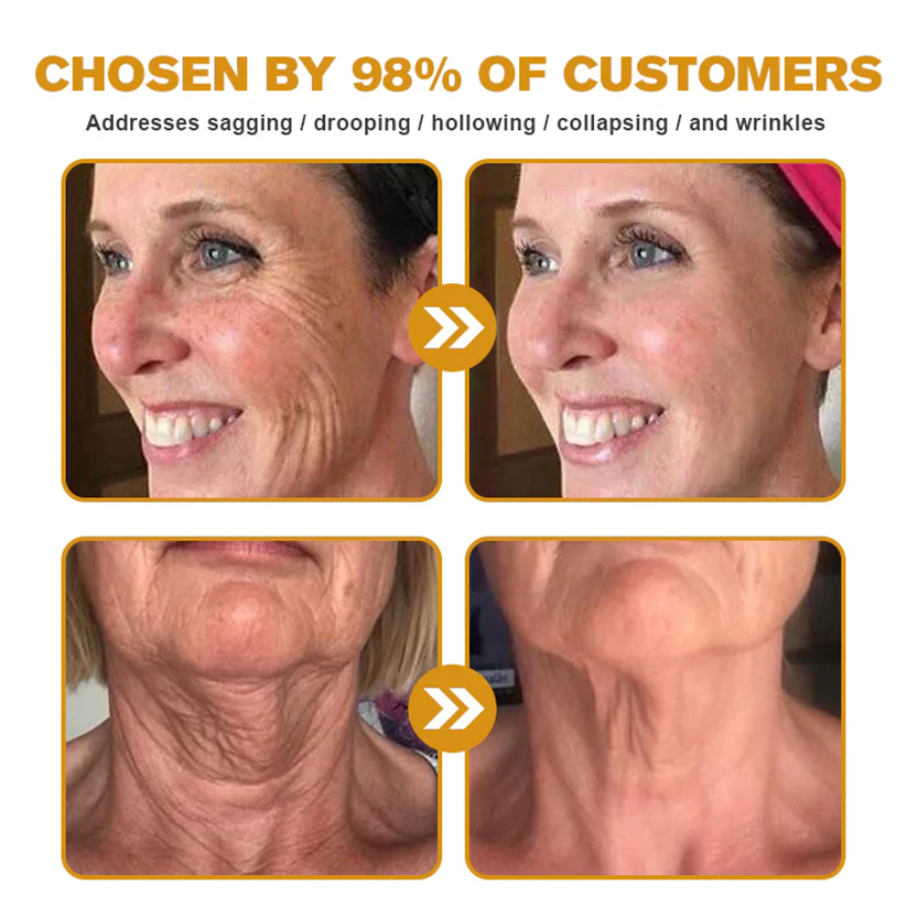 🌤️FDA Approved: Ourlyard® Bee Venom Skin Restoration Cream — 🥇Limited Time 80% OFF🔥
