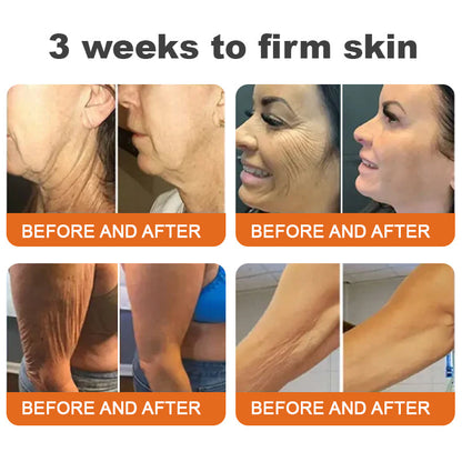 🐝🔥🐝Made and Shipped from USA✨Flysmus® Botox Bee Venom Firming Serum Stick🔥LAST DAY 70% OFF