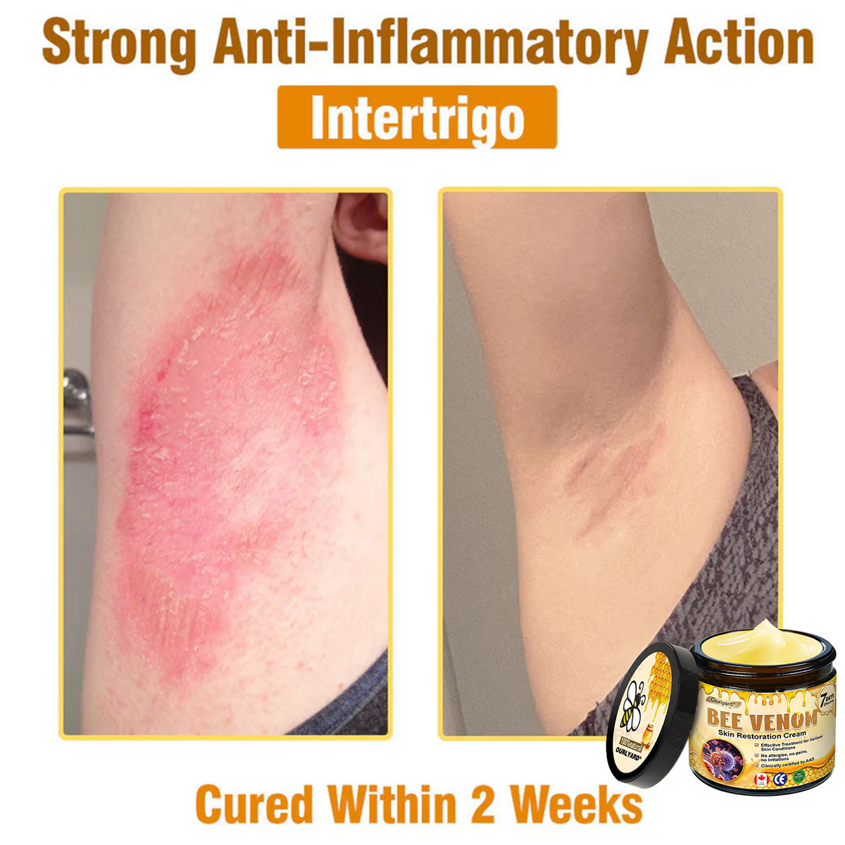 🍁Ourlyard® Bee venom Pro Comprehensive Cream — 🔥Limited Time 80% OFF🔥
