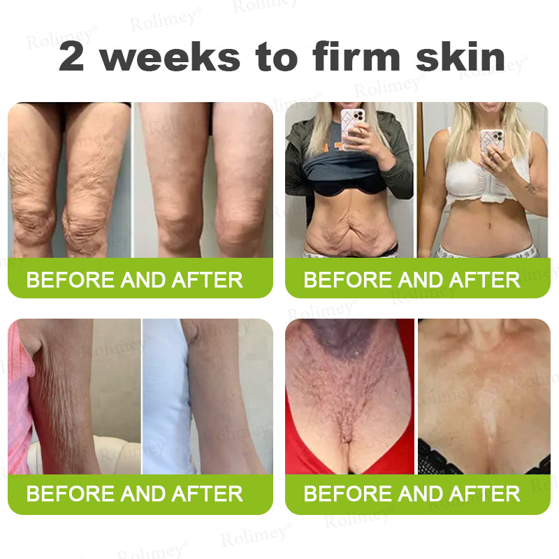 💟Made and shipped from the USA 💫Rolimey® Botox & Vita-A Retinol Shot Wrinkle-Lift Tightening cream - Last Day Promotion 70% OFF