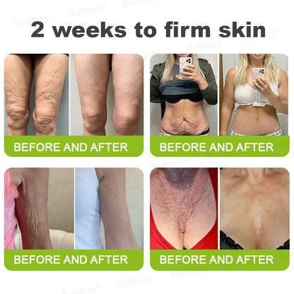 💟Made and shipped from the USA 💫Rolimey® Botox & Vita-A Retinol Shot Wrinkle-Lift Tightening cream - Last Day Promotion 70% OFF