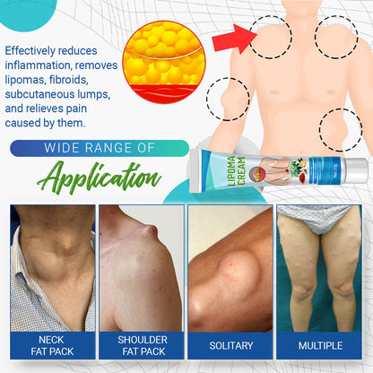 LumpFree™ Lipoma Removal Cream