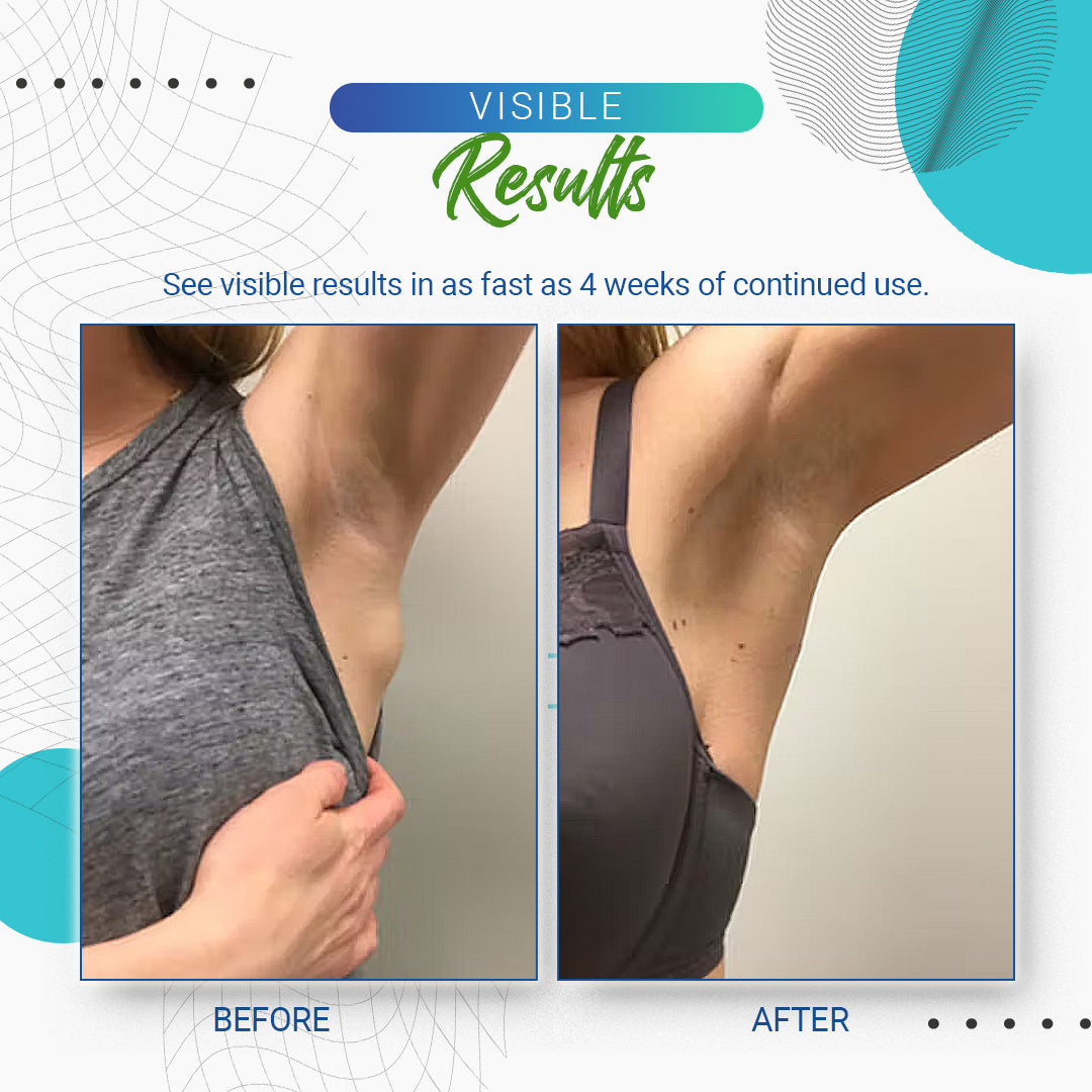 LumpFree™ Lipoma Removal Cream