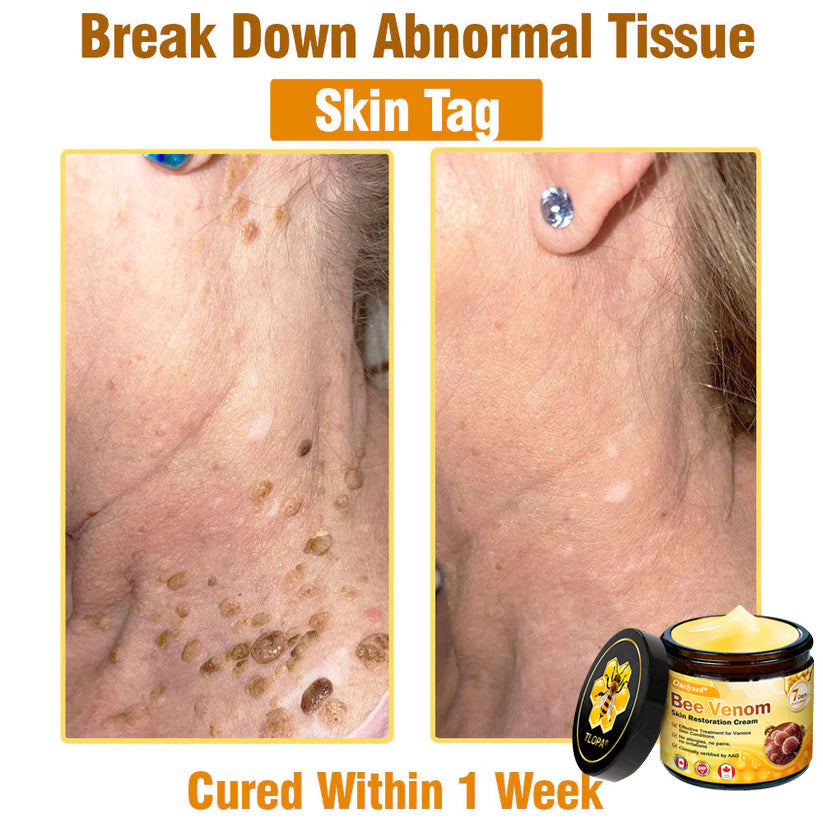 🌤️FDA Approved: Ourlyard® Bee Venom Skin Restoration Cream — 🥇Limited Time 80% OFF🔥