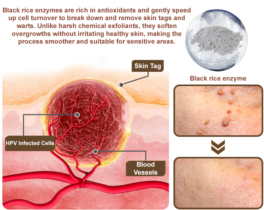 🌊💎Zvoevo® Black Rice Skin Repair Essence Cream ⚕️ FDA Certified (Removes warts and skin growths, improves keratin buildup and seborrheic dermatitis, follicular keratosis, age spots, and bruising)