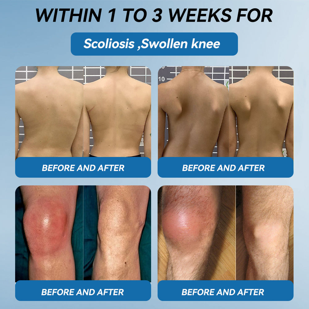 👩‍⚕️🦴FDA Approved|𝒁𝐯𝐨𝐞𝐯𝐨® BPC-157 Joint Healing Cream 🦴 Treats Arthritis, Neuropathy, Rheumatism, Sports Injuries & More