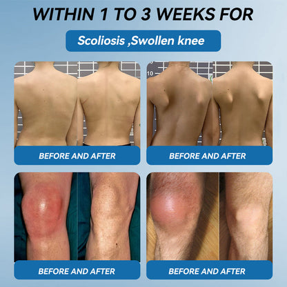 👩‍⚕️🦴FDA Approved|𝒁𝐯𝐨𝐞𝐯𝐨® BPC-157 Joint Healing Cream 🦴 Treats Arthritis, Neuropathy, Rheumatism, Sports Injuries & More