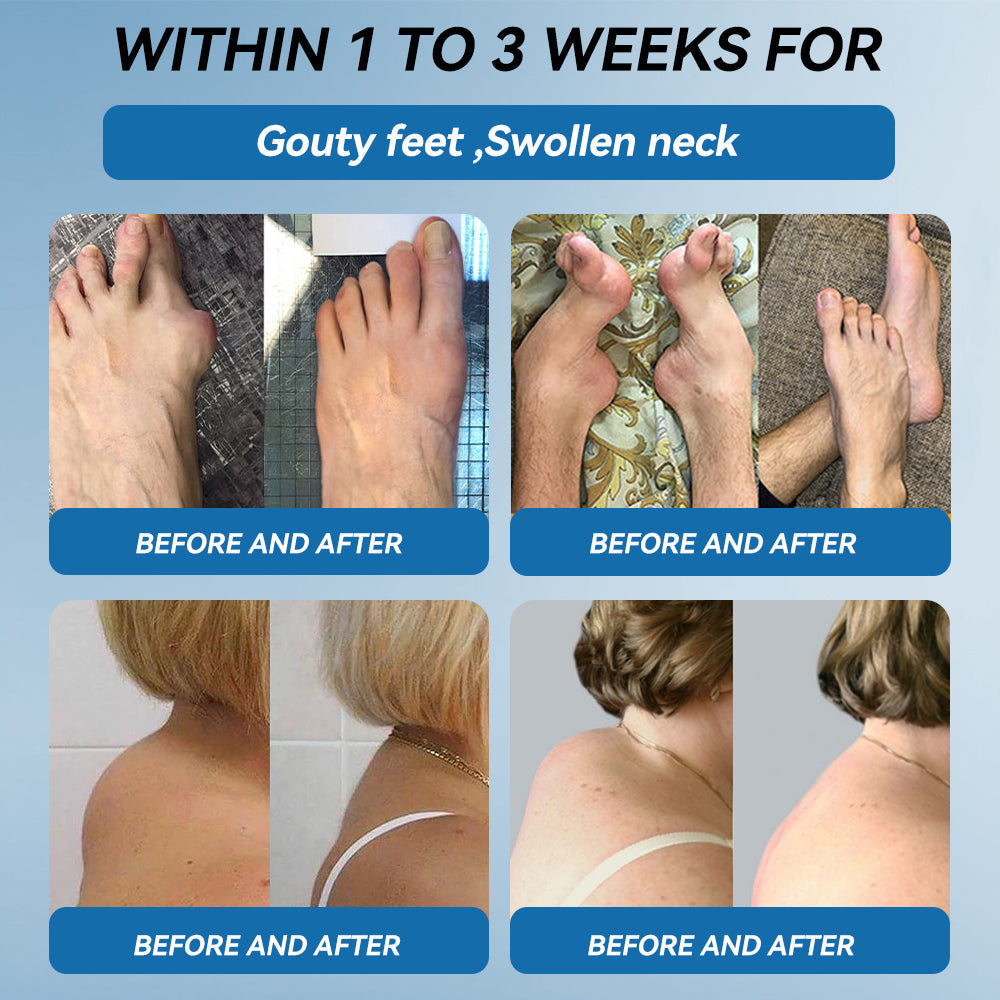 👩‍⚕️🦴FDA Approved|𝒁𝐯𝐨𝐞𝐯𝐨® BPC-157 Joint Healing Cream 🦴 Treats Arthritis, Neuropathy, Rheumatism, Sports Injuries & More