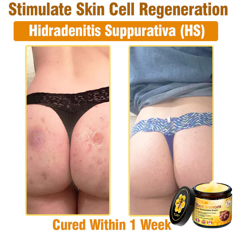 🌤️FDA Approved: Ourlyard® Bee Venom Skin Restoration Cream — 🥇Limited Time 80% OFF🔥