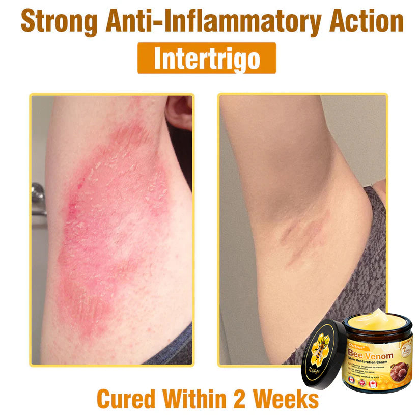 🌤️FDA Approved: Ourlyard® Bee Venom Skin Restoration Cream — 🥇Limited Time 80% OFF🔥