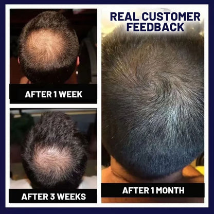 🌿 HZA™ Natural Hair Regrowth Spray – 70% OFF Ends Tonight!