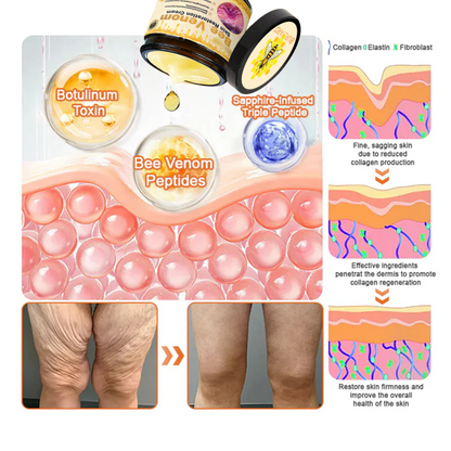 🍁Ourlyard® Bee venom Pro Comprehensive Cream — 🔥Limited Time 80% OFF🔥