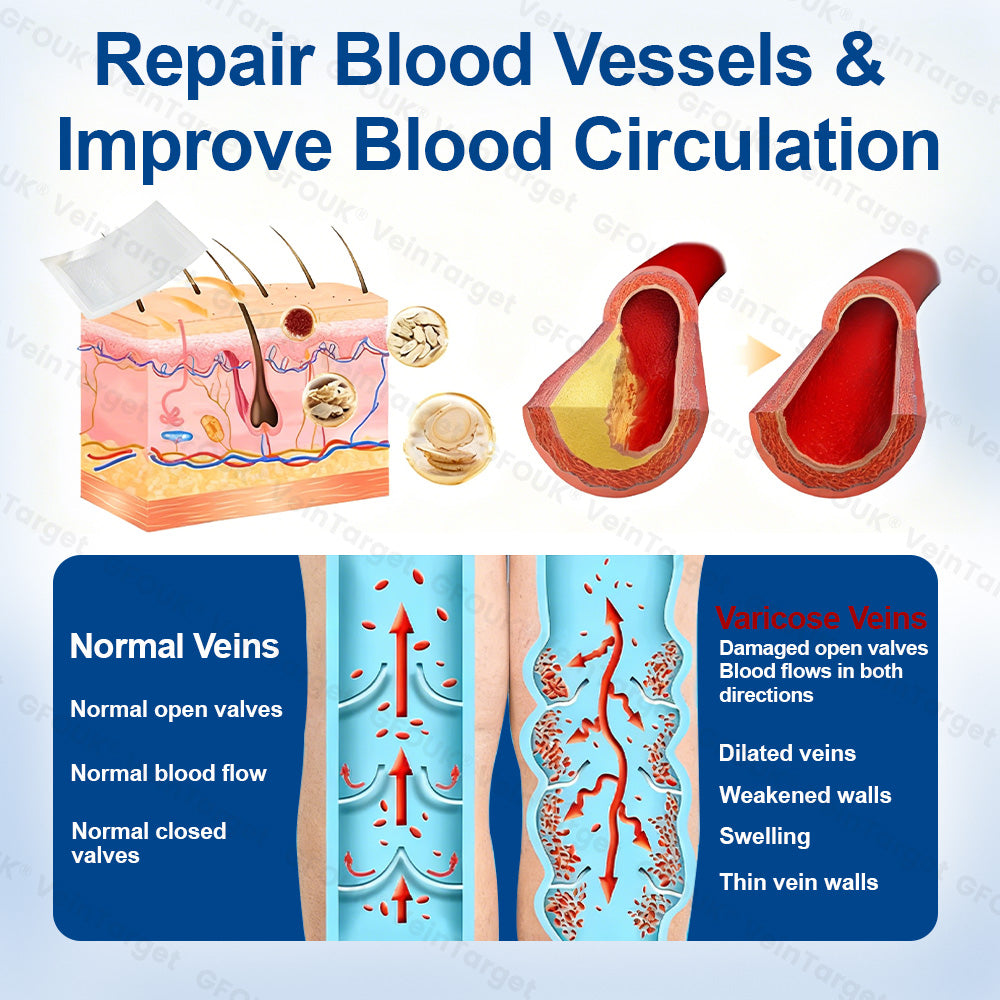 💟💟GFOUK® VeinPulse Advanced Transdermal Microneedle System⚡Instant Relief, Long-Term Results