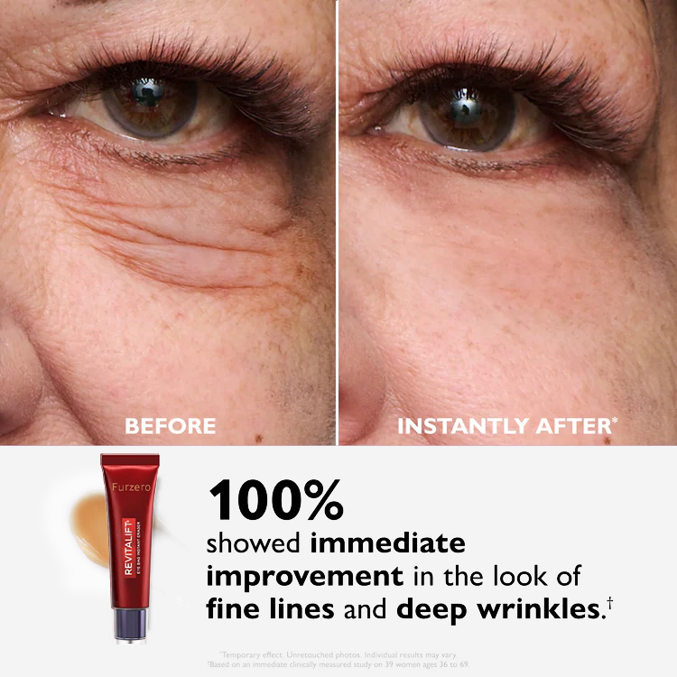 🔥  Last 3 Hours 50% OFF  ✨ BUY 1 GET 1 FREE🔥Eye Bag Eraser — Instantly Refreshes, Firms & Smooths for a Youthful Look That Lasts 8 Hours