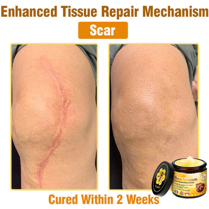 🌤️FDA Approved: Ourlyard® Bee Venom Skin Restoration Cream — 🥇Limited Time 80% OFF🔥