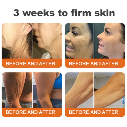 🐝🐝FDA Approved: Ourlyard® Bee venom Pro Comprehensive Cream — 🔥Limited Time 80% OFF🔥