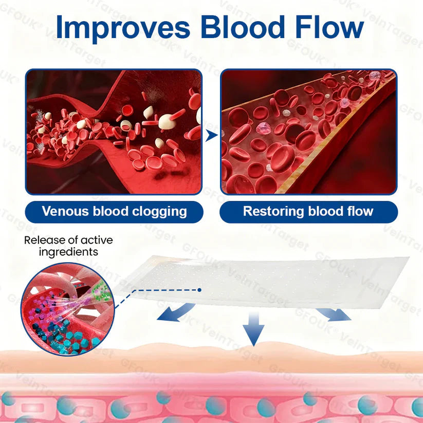 💟💟GFOUK® VeinPulse Advanced Transdermal Microneedle System⚡Instant Relief, Long-Term Results