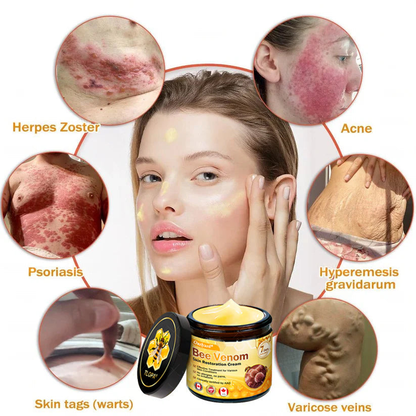 🌤️FDA Approved: Ourlyard® Bee Venom Skin Restoration Cream — 🥇Limited Time 80% OFF🔥