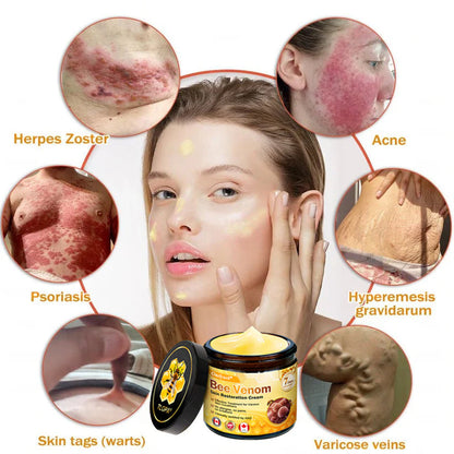 🌤️FDA Approved: Ourlyard® Bee Venom Skin Restoration Cream — 🥇Limited Time 80% OFF🔥