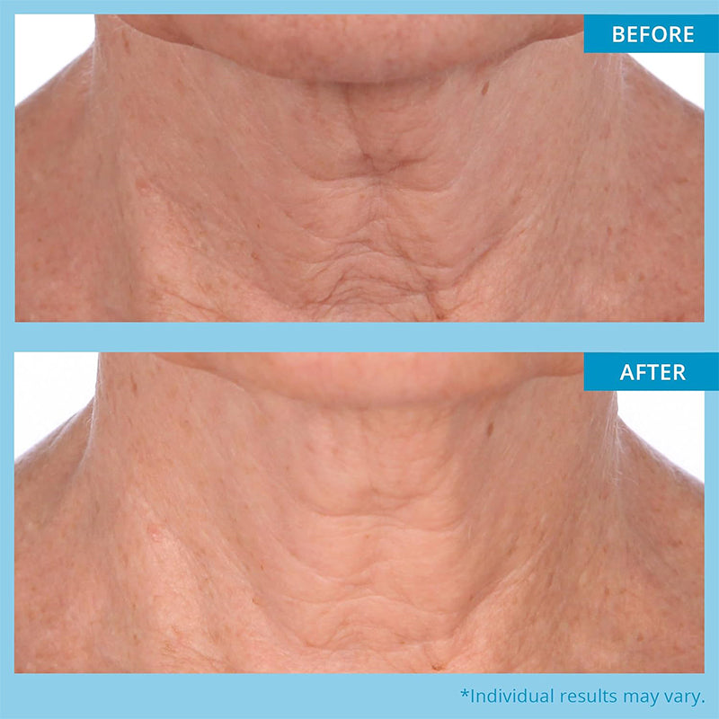 Newyuo™ Neck Leave-On Mask, Anti-Aging Neck Cream for Fine Lines, Wrinkles and Crepey Skin