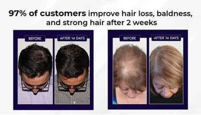 🌿 HZA™ Natural Hair Regrowth Spray – 70% OFF Ends Tonight!