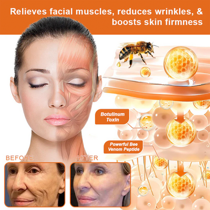 🐝🐝FDA Approved: Ourlyard® Bee venom Pro Comprehensive Cream — 🔥Limited Time 80% OFF🔥