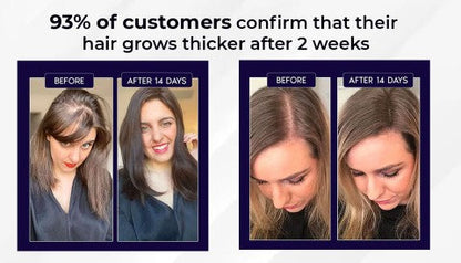 🌿 HZA™ Natural Hair Regrowth Spray – 70% OFF Ends Tonight!