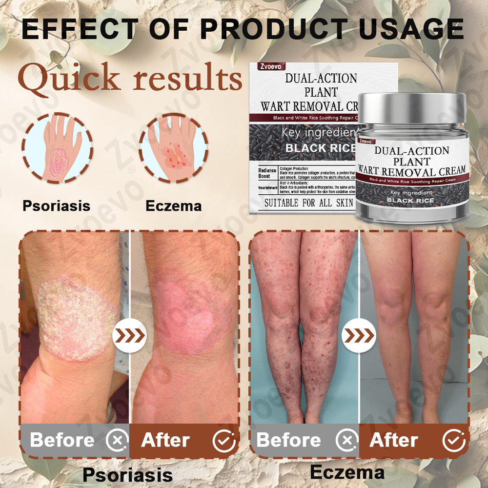 🌊💎Zvoevo® Black Rice Skin Repair Essence Cream ⚕️ FDA Certified (Removes warts and skin growths, improves keratin buildup and seborrheic dermatitis, follicular keratosis, age spots, and bruising)