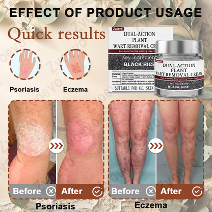 🌊💎Zvoevo® Black Rice Skin Repair Essence Cream ⚕️ FDA Certified (Removes warts and skin growths, improves keratin buildup and seborrheic dermatitis, follicular keratosis, age spots, and bruising)
