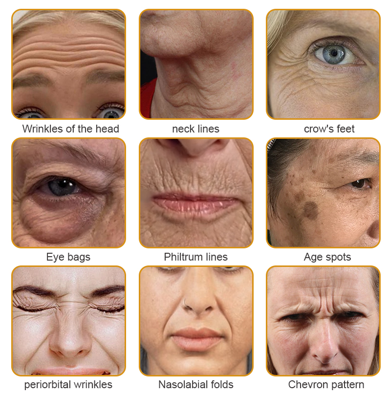💎🍀Made and Shipped from the USA ✅Furzero™ Botox Bee Venom Wrinkle Removal Cream-Last Day Promotion 70% OFF