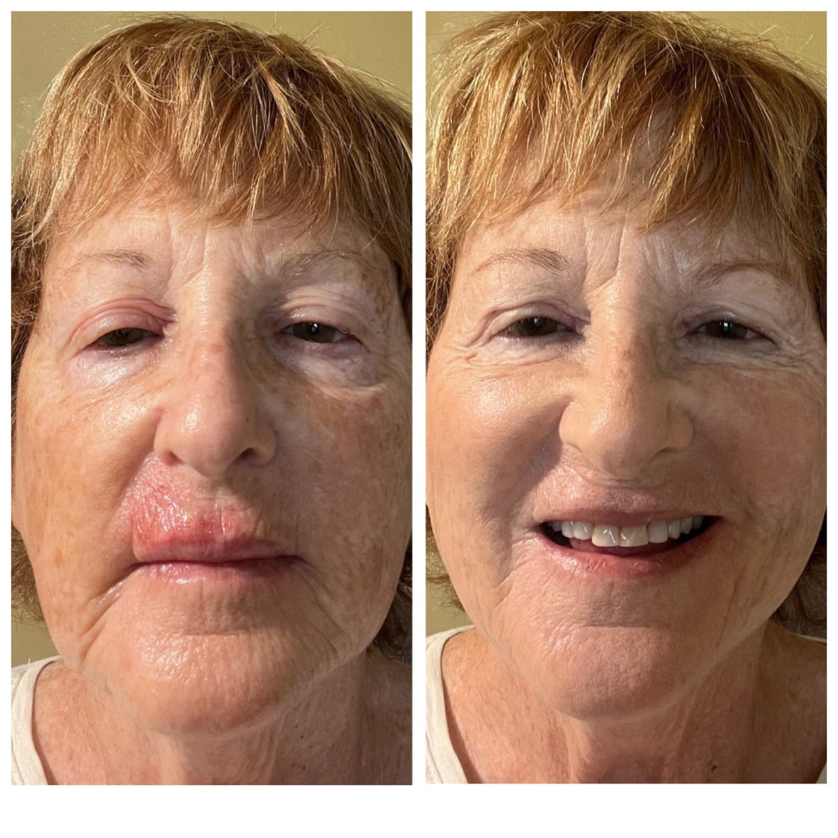 💟Last 3 hours 60% off🔥Skin Tone Adjusting CC Cream SPF(Free Contour Brush)