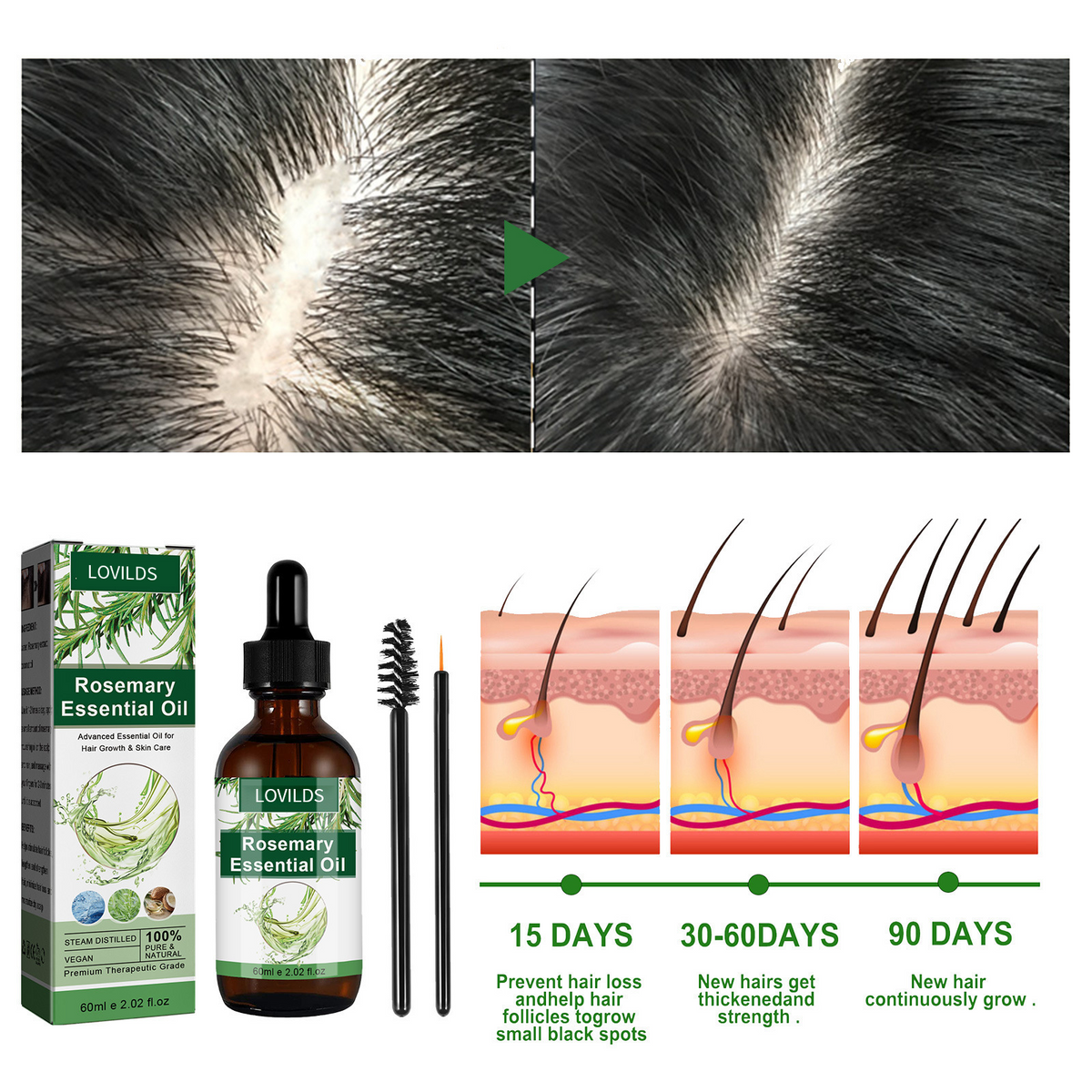 LOVILDS Rosemary Essential Oil – Strengthens Hair  Promotes Thicker Growth  Deeply Nourishing & Multi-Use for Scalp and Skin Care