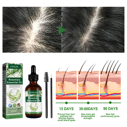 LOVILDS Rosemary Essential Oil – Strengthens Hair  Promotes Thicker Growth  Deeply Nourishing & Multi-Use for Scalp and Skin Care