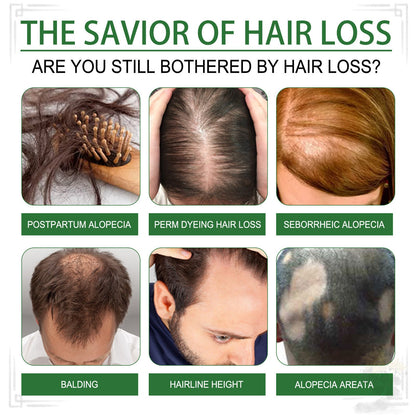 LOVILDS Rosemary Essential Oil – Strengthens Hair  Promotes Thicker Growth  Deeply Nourishing & Multi-Use for Scalp and Skin Care