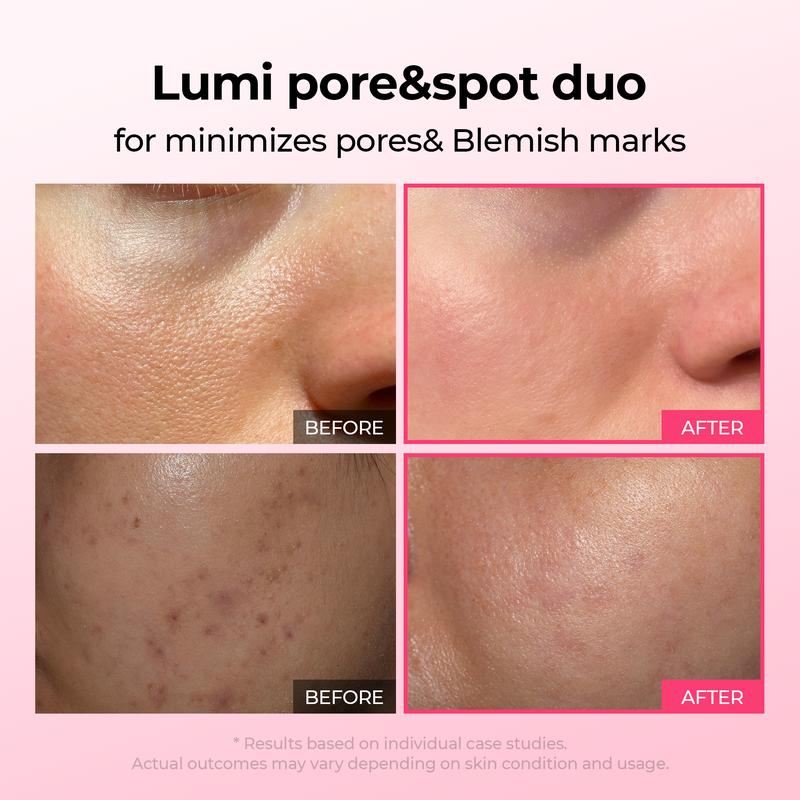 [Divifit]✨Lumi Pore & Spot Care Duo | Shrinks Pores & Fades Blemish Marks | Cyano Pink Spicule Serum + Picotonic Shot Ampoule  [🔥Limited Time Offer🔥]