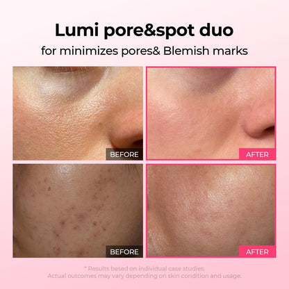 [Divifit]✨Lumi Pore & Spot Care Duo | Shrinks Pores & Fades Blemish Marks | Cyano Pink Spicule Serum + Picotonic Shot Ampoule  [🔥Limited Time Offer🔥]